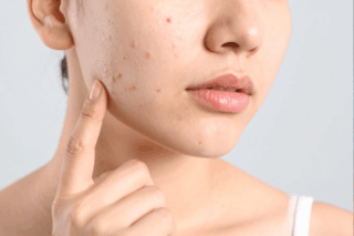 ニキビ占い完全ガイド｜位置と色でわかる運勢と開運メッセージ